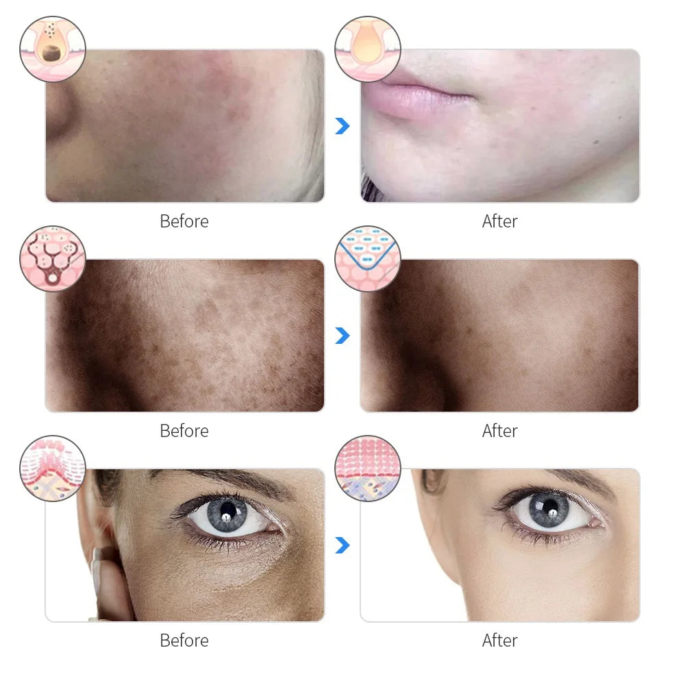 GlowPro Advanced LED Facial Mask